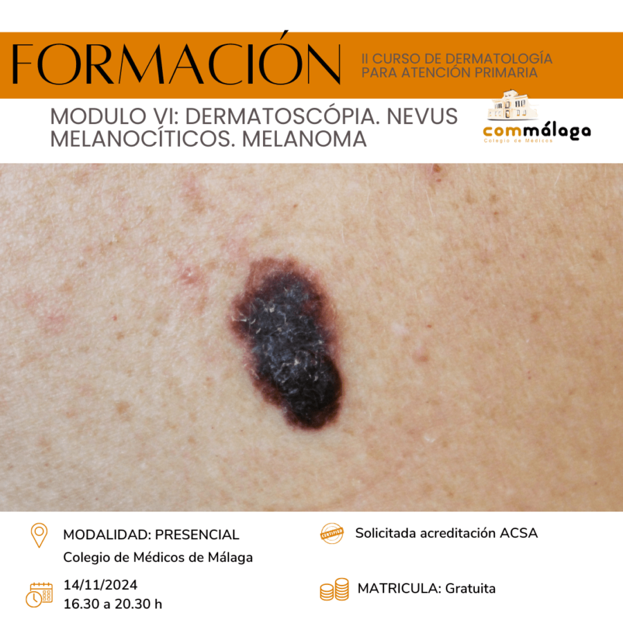 Módulo VI. Actualización en dermatoscopia, nevus melanocíticos y melanoma | 14 de noviembre