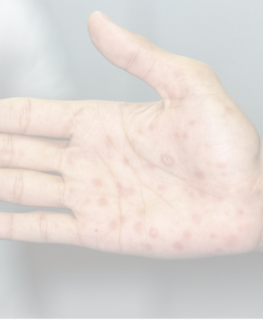 Enfermedades Sistémicas con manifestaciones cutáneas y ETS  | IV Ciclo de dermatología para AP | 1 al 30 de noviembre